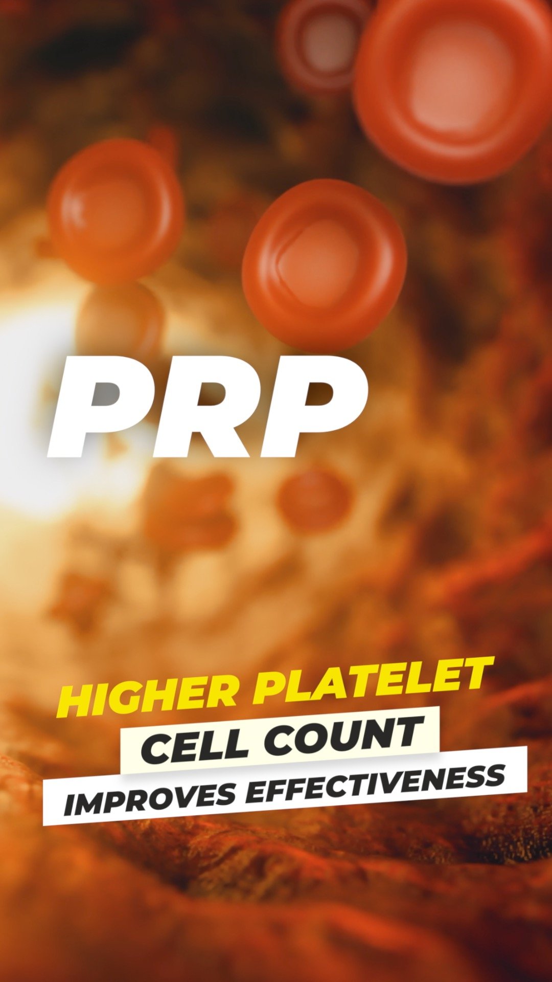 Illustration of blood cells with the text "PRP" and information about higher platelet cell count improving effectiveness.