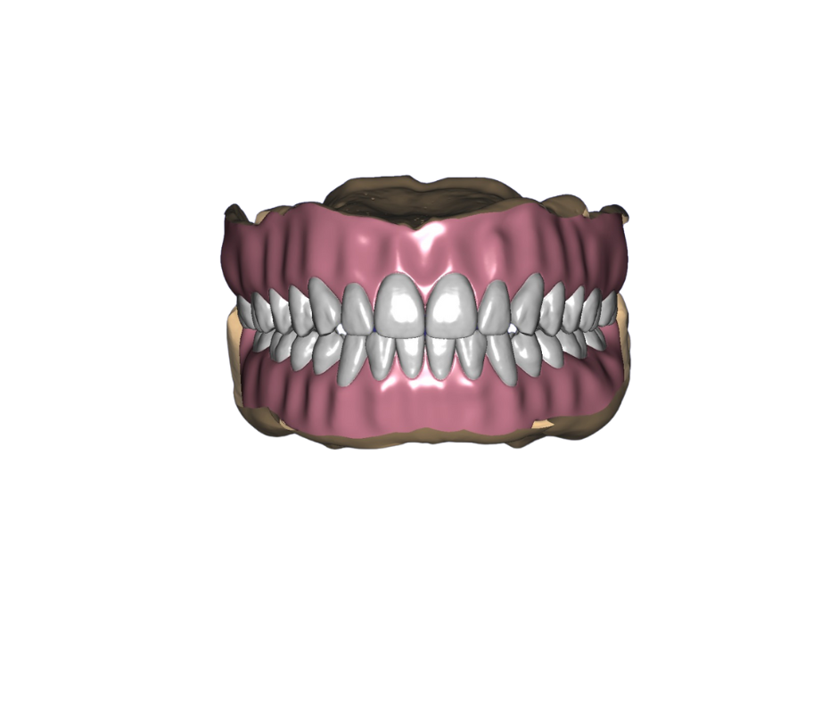 3D digital model of a human mouth showing upper and lower teeth with gums.