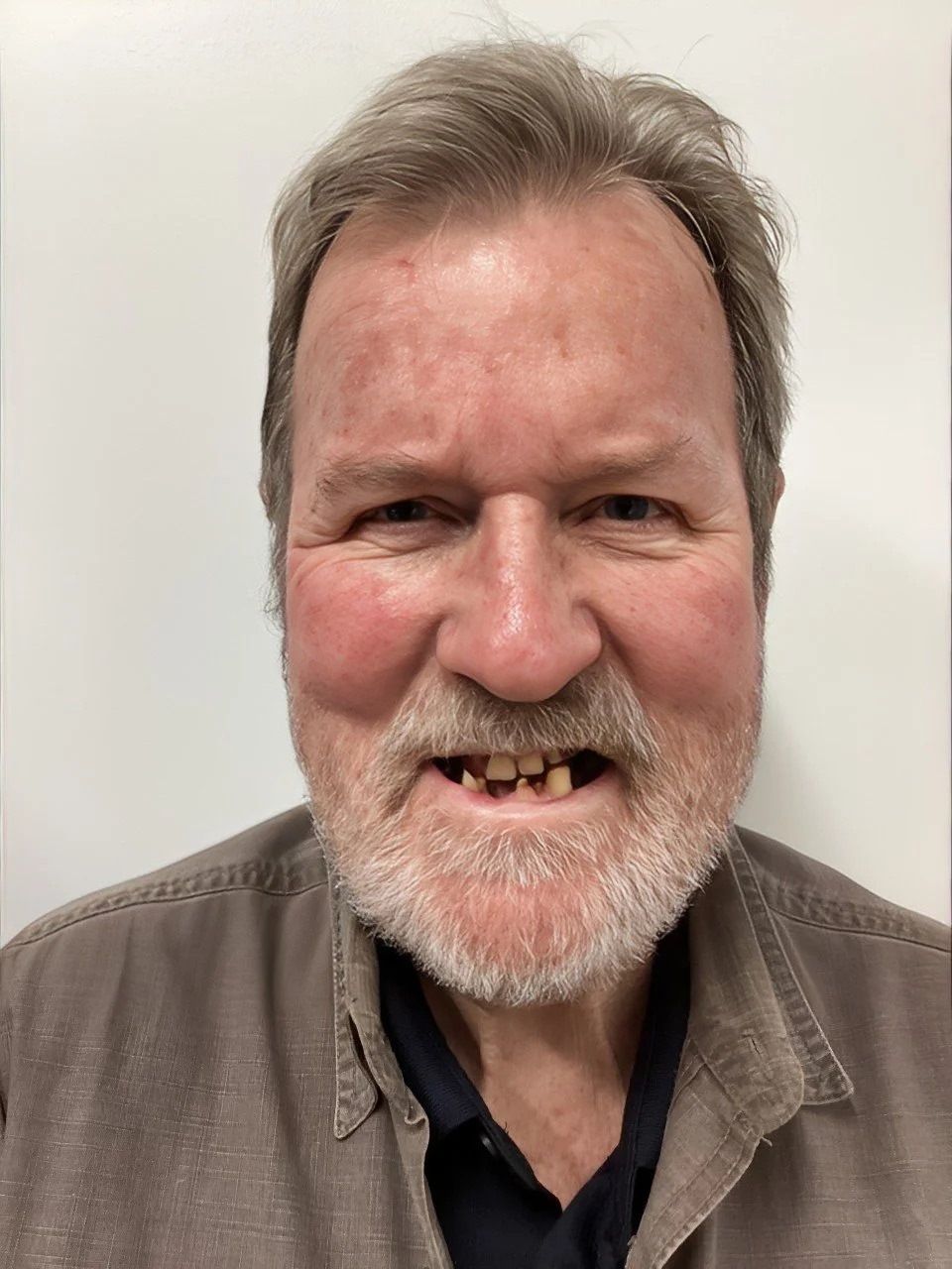 A man with gray hair and a beard, smiling with missing and discolored teeth, wearing a brown jacket over a black shirt.