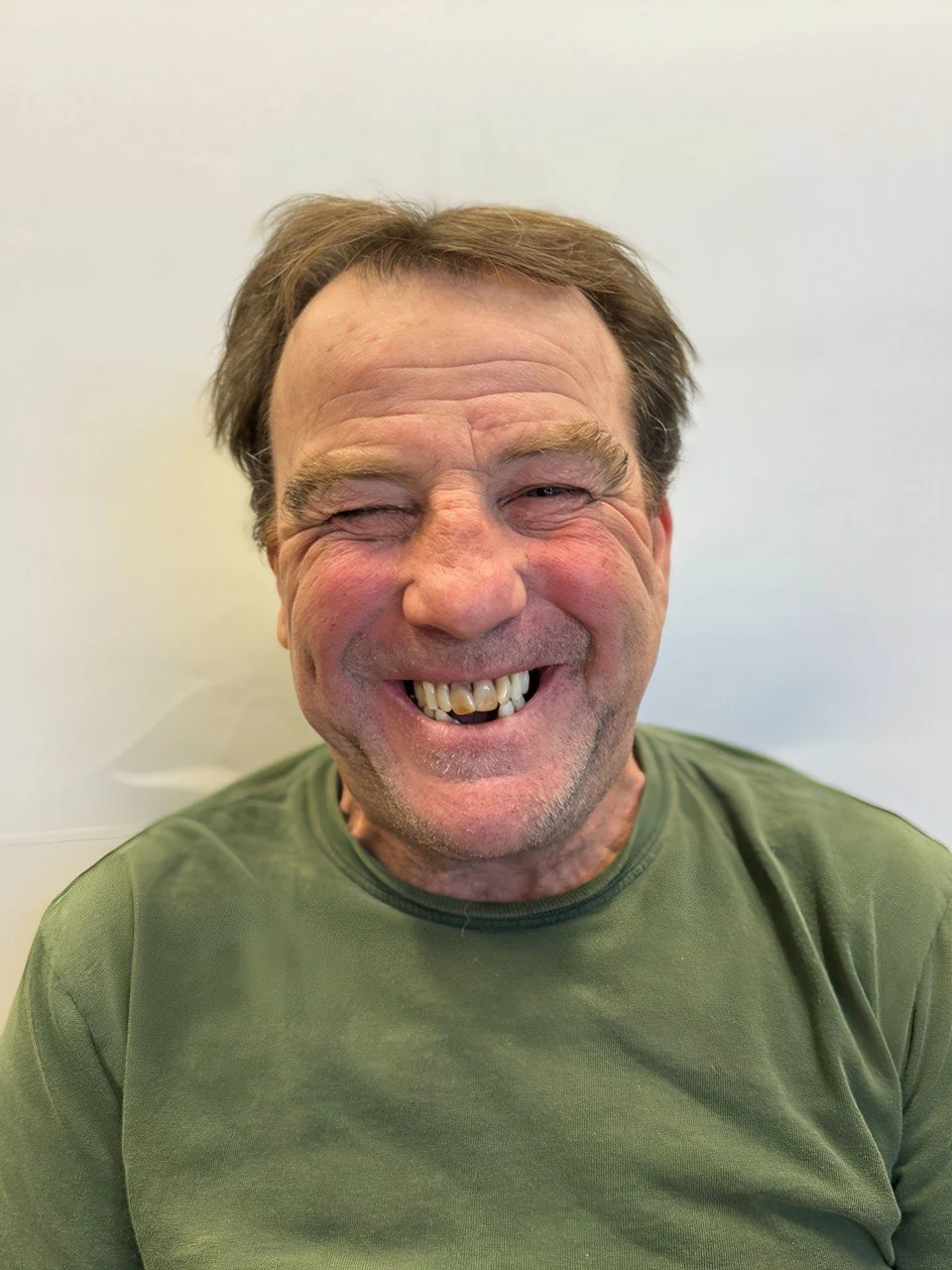 A smiling middle-aged man with a missing front tooth and a crooked smile, wearing a green shirt, against a plain white background.