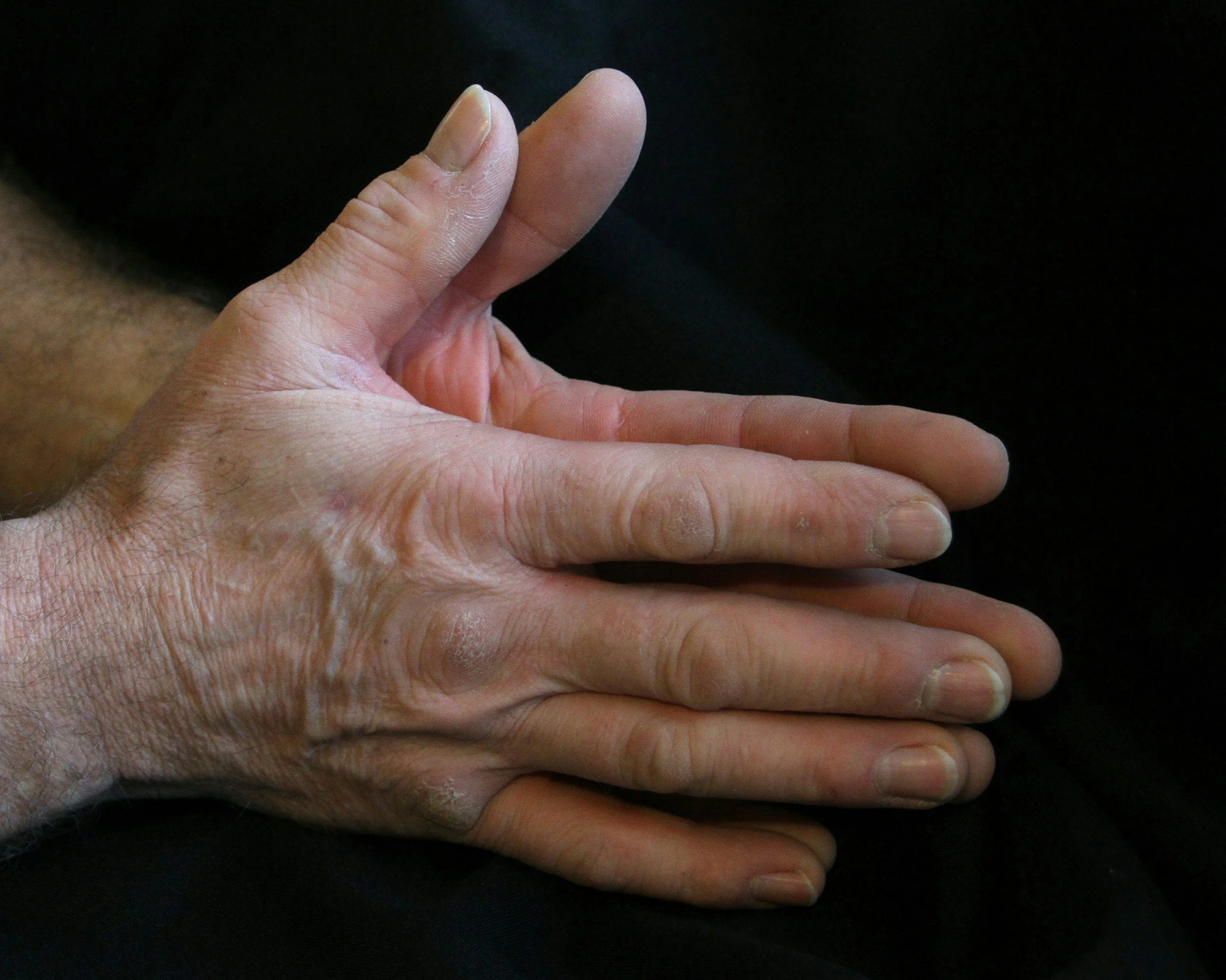 Two hands clasped together resting on a black fabric surface.