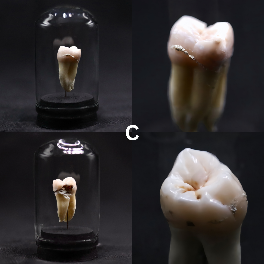 Human Tooth Mini Dome | Multiple Options