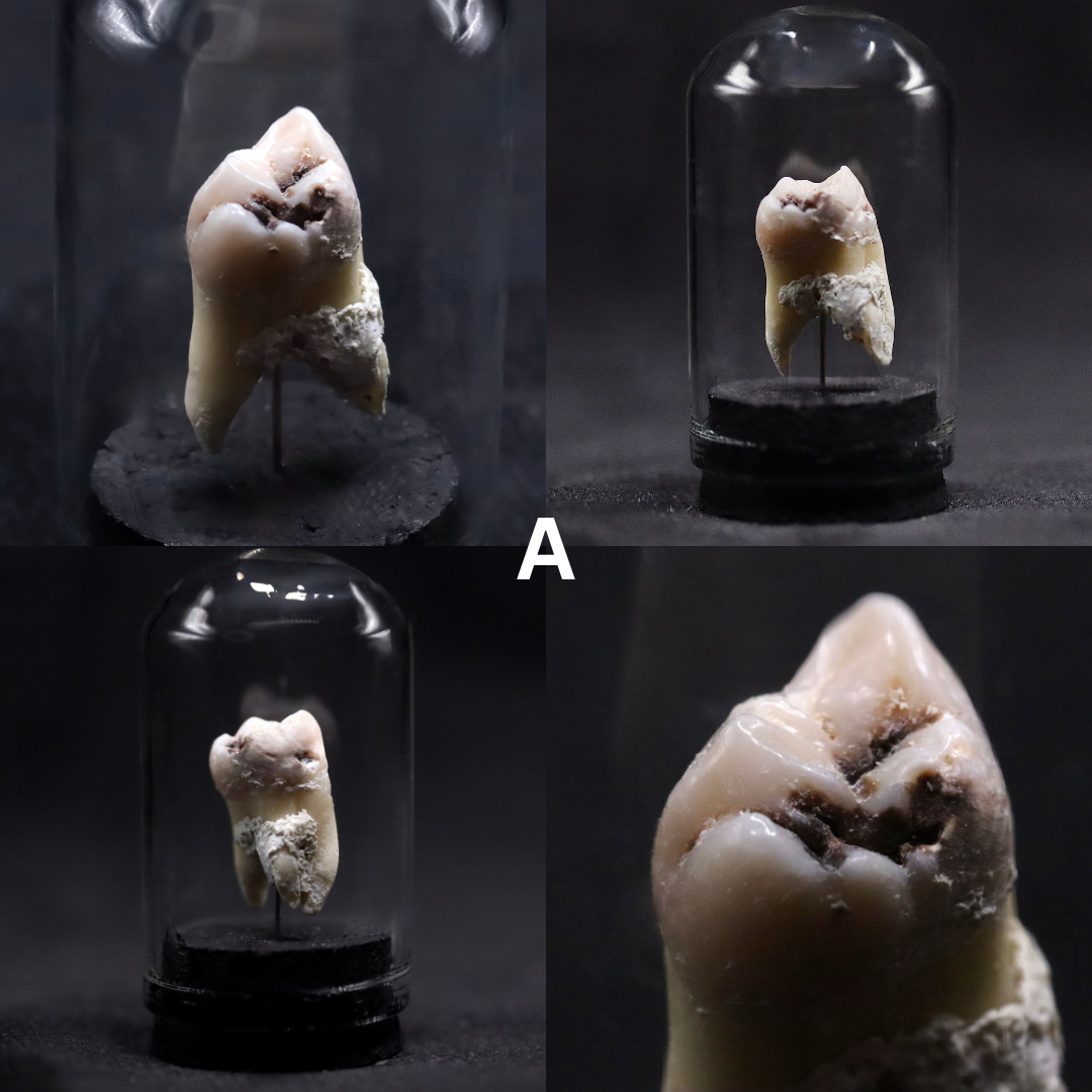 Human Tooth Mini Dome | Multiple Options