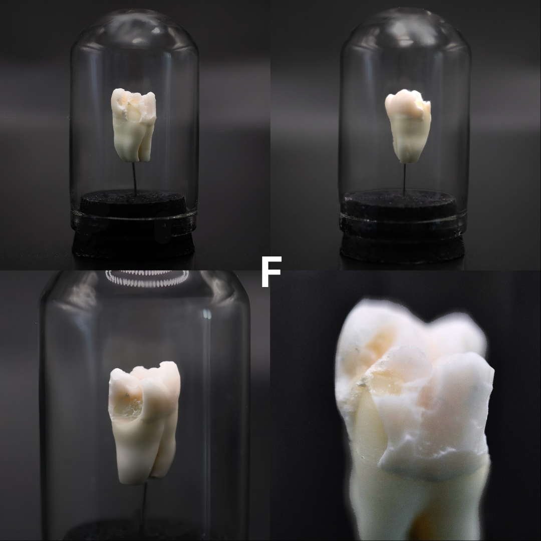 Human Tooth Mini Dome | Multiple Options