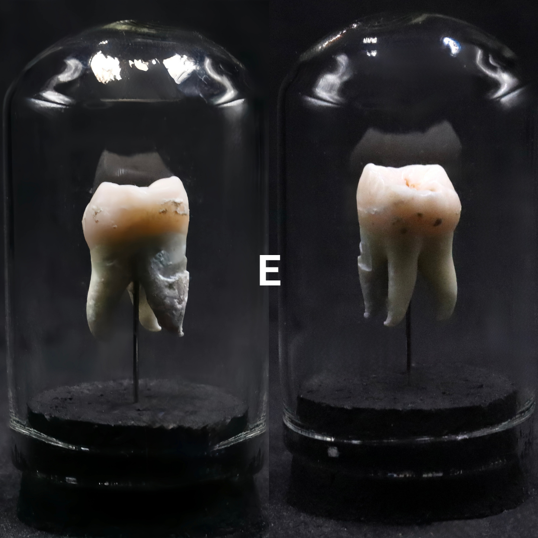 Human Tooth Mini Dome | Multiple Options