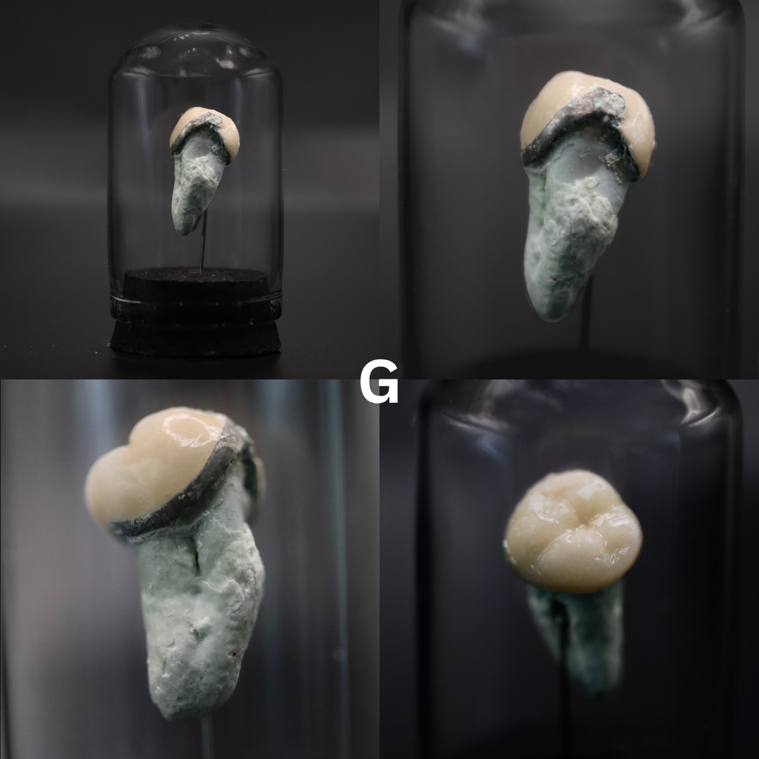 Human Tooth Mini Dome | Multiple Options
