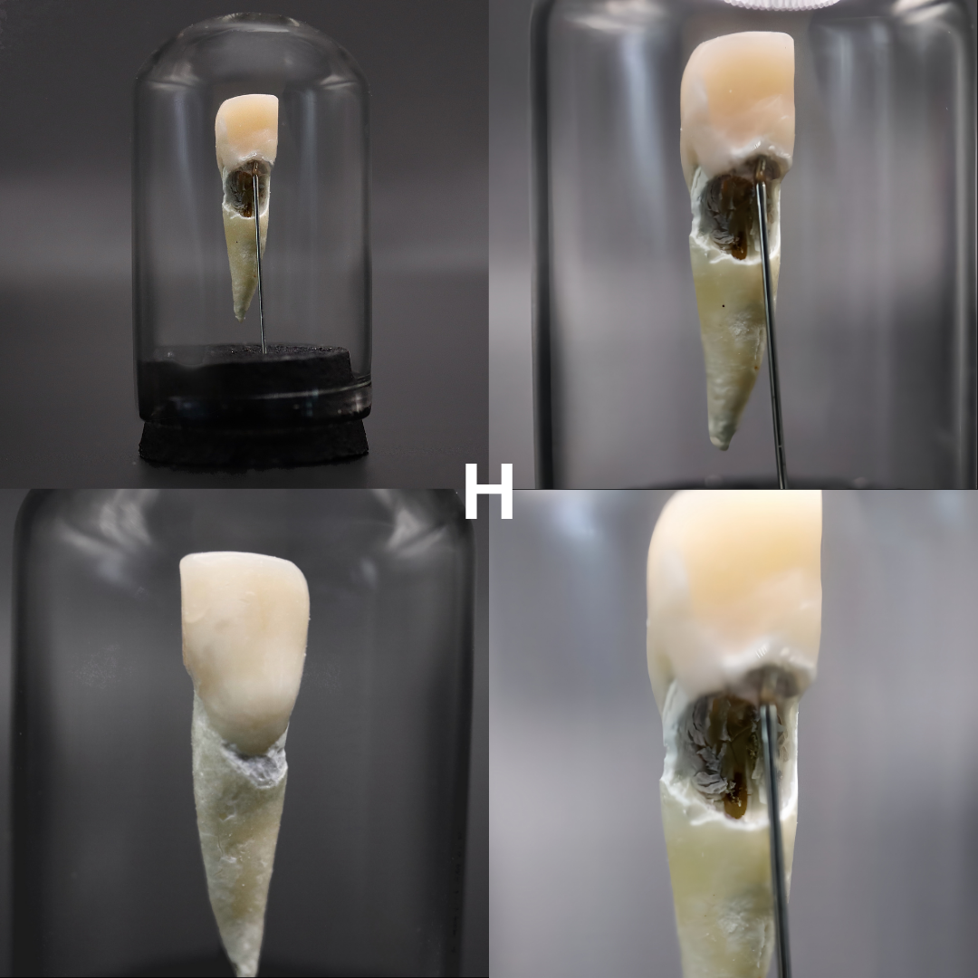 Human Tooth Mini Dome | Multiple Options