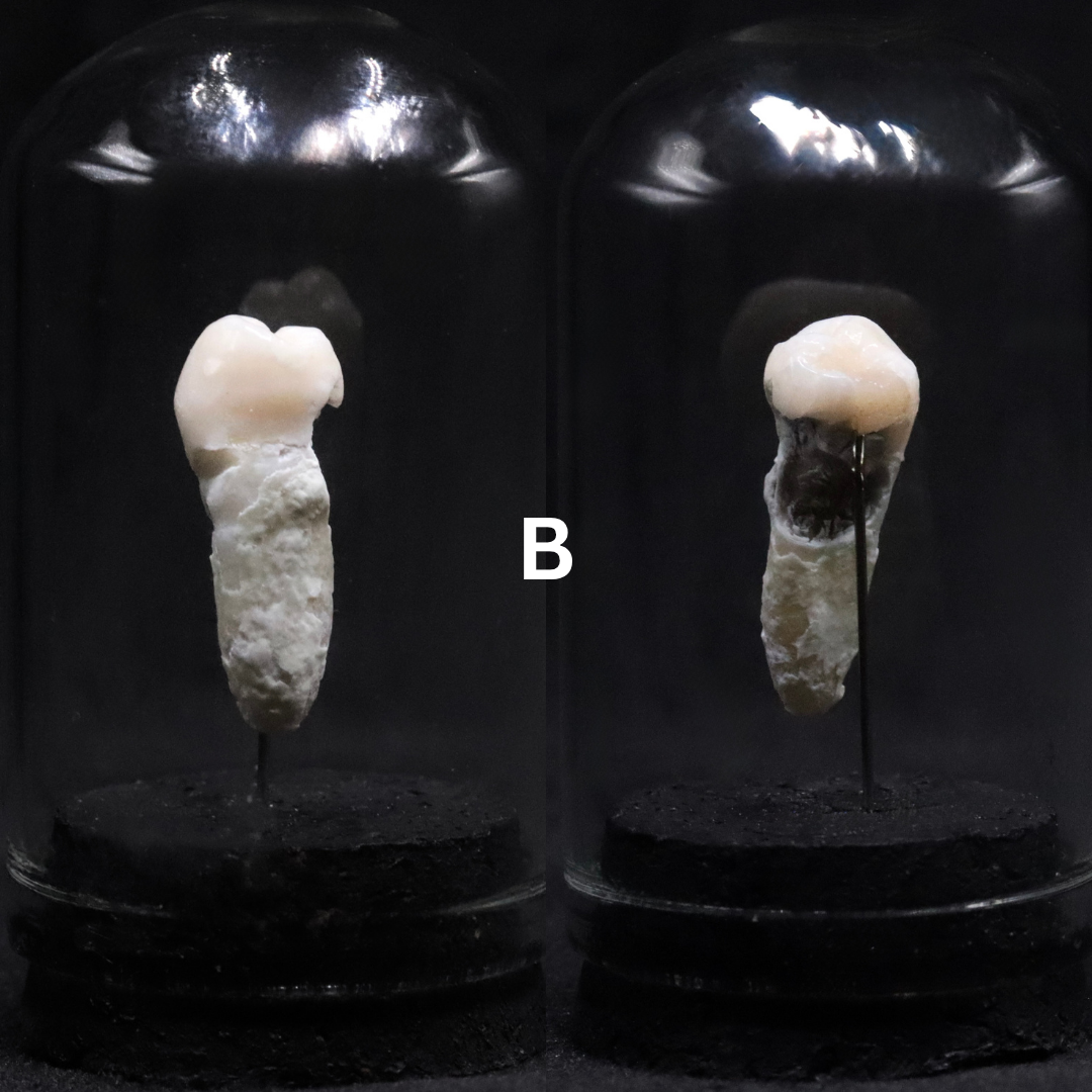 Human Tooth Mini Dome | Multiple Options