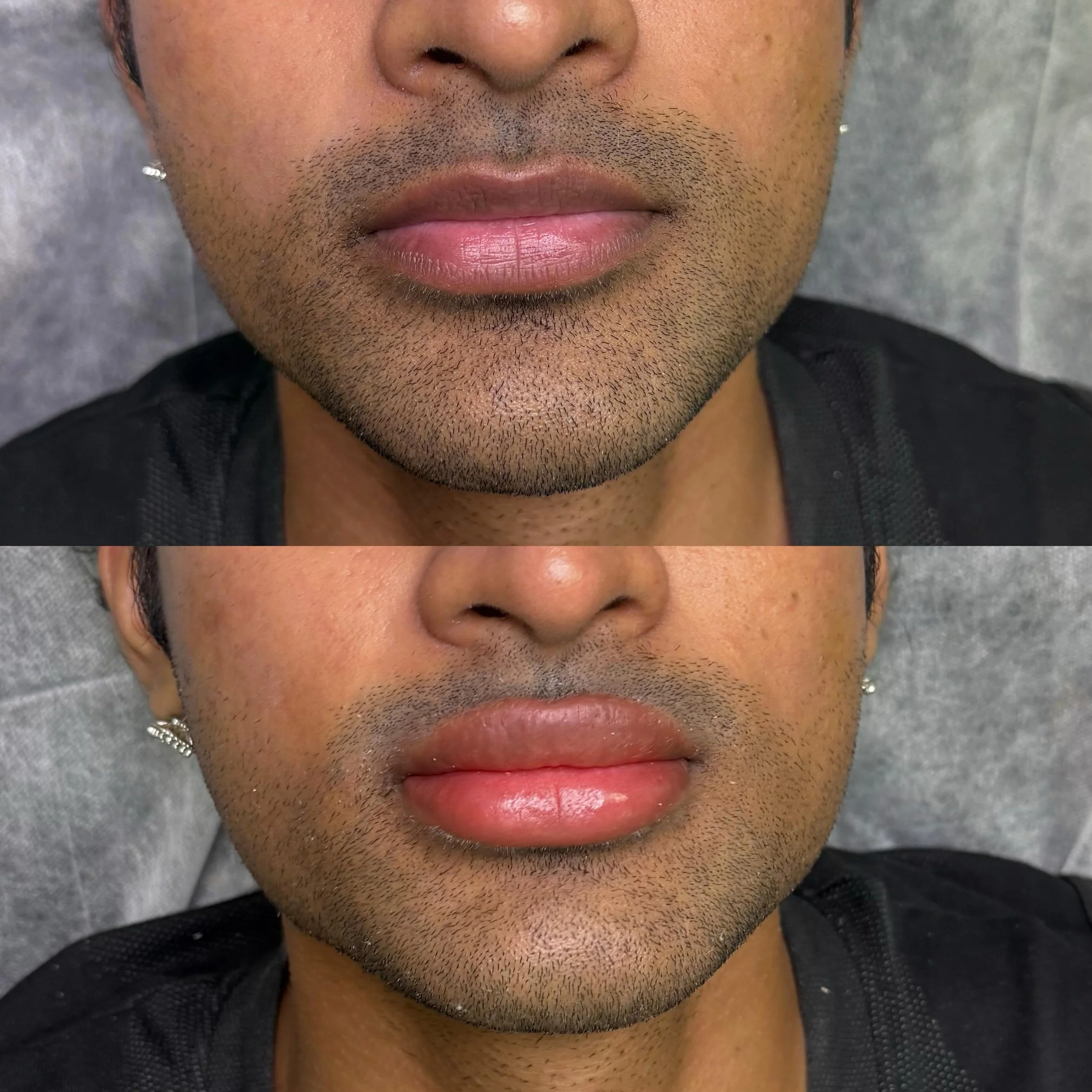 Lip blush isn&rsquo;t just for women &mdash; refined, natural-looking results are for everyone. ✨

First lip neutralization session focused on balancing undertones and restoring a more even, healthy lip tone while keeping the finish subtle and mascul