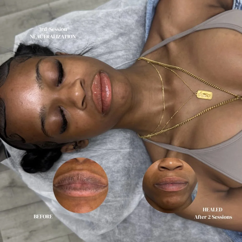 💋 Lip Neutralization Journey 💋

Results like these take time, patience, and trust in the process.
This photo shows my client&rsquo;s starting point compared to her healed results 7 months later after two lip neutralization sessions. ✨

Lip neutrali