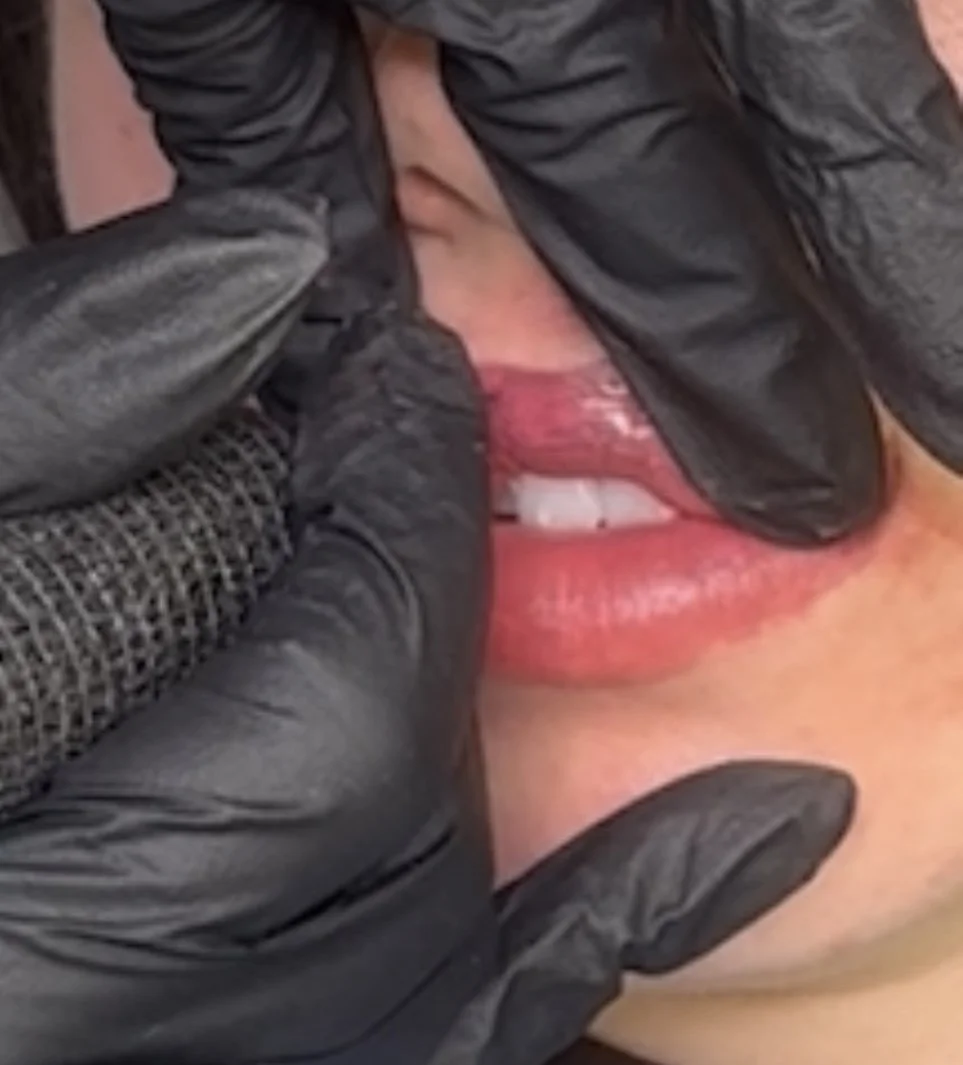 Close-up of a person's lips and teeth, with a black gloved hand touching the face while pigment is being applied during a lip blush treatment.
