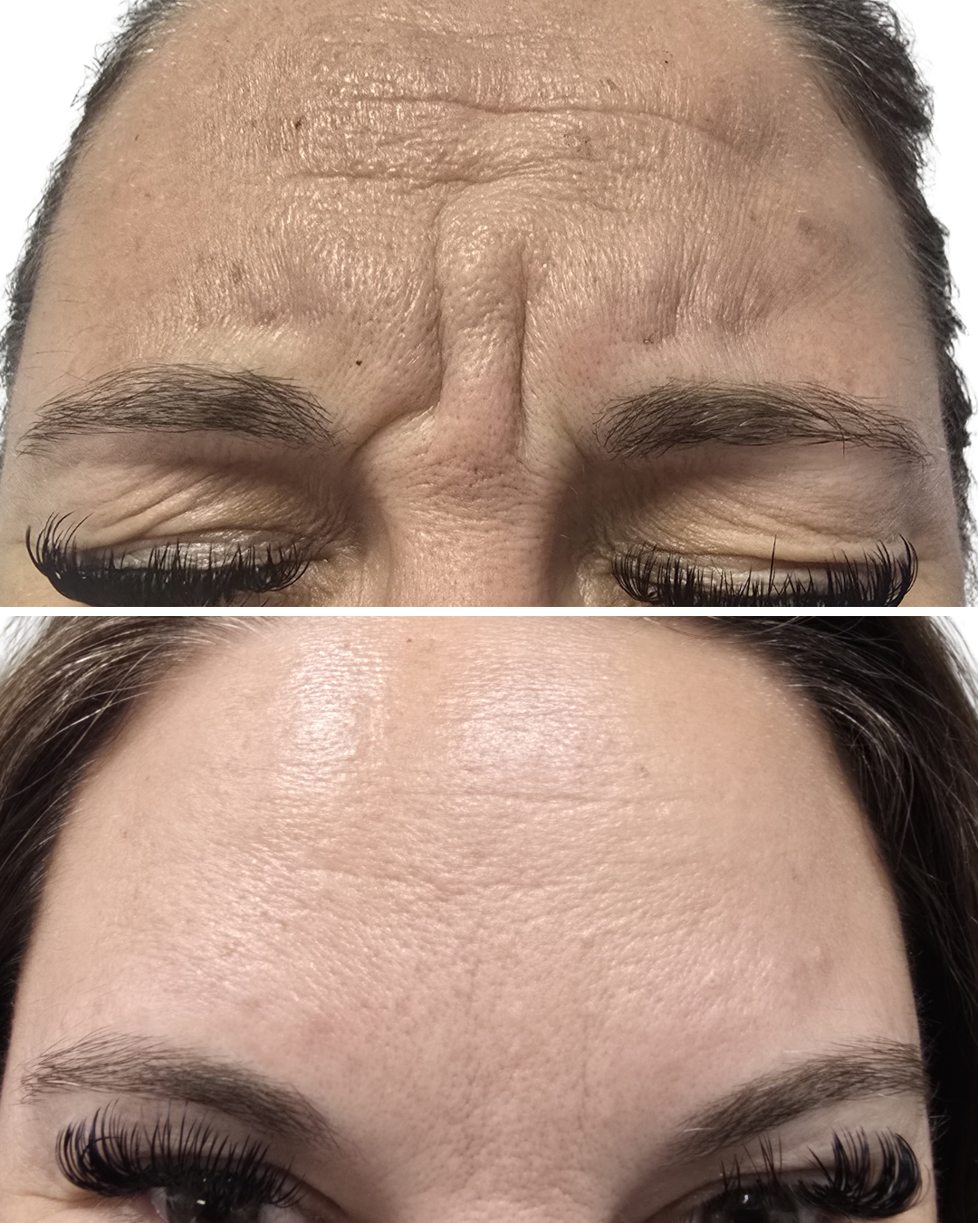 Spring Skin Refresh: The Best Treatments to Rejuvenate Your Look in Albuquerque