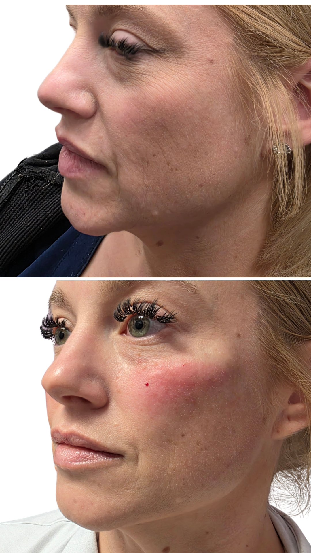 Facial Balancing
Strategic enhancement to refine profile structure and support overall facial balance.