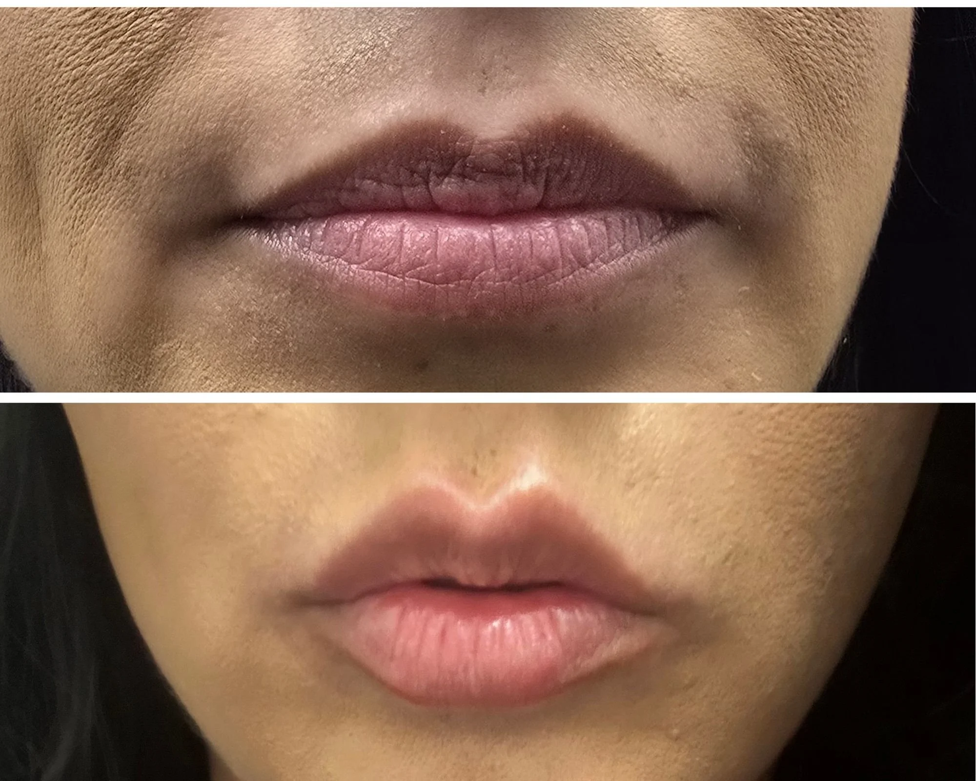 Close-up of the lower face of a person, showing the lips before and after makeup or cosmetic procedure, with the top image displaying natural lips and the bottom showing enhanced or altered lips.
