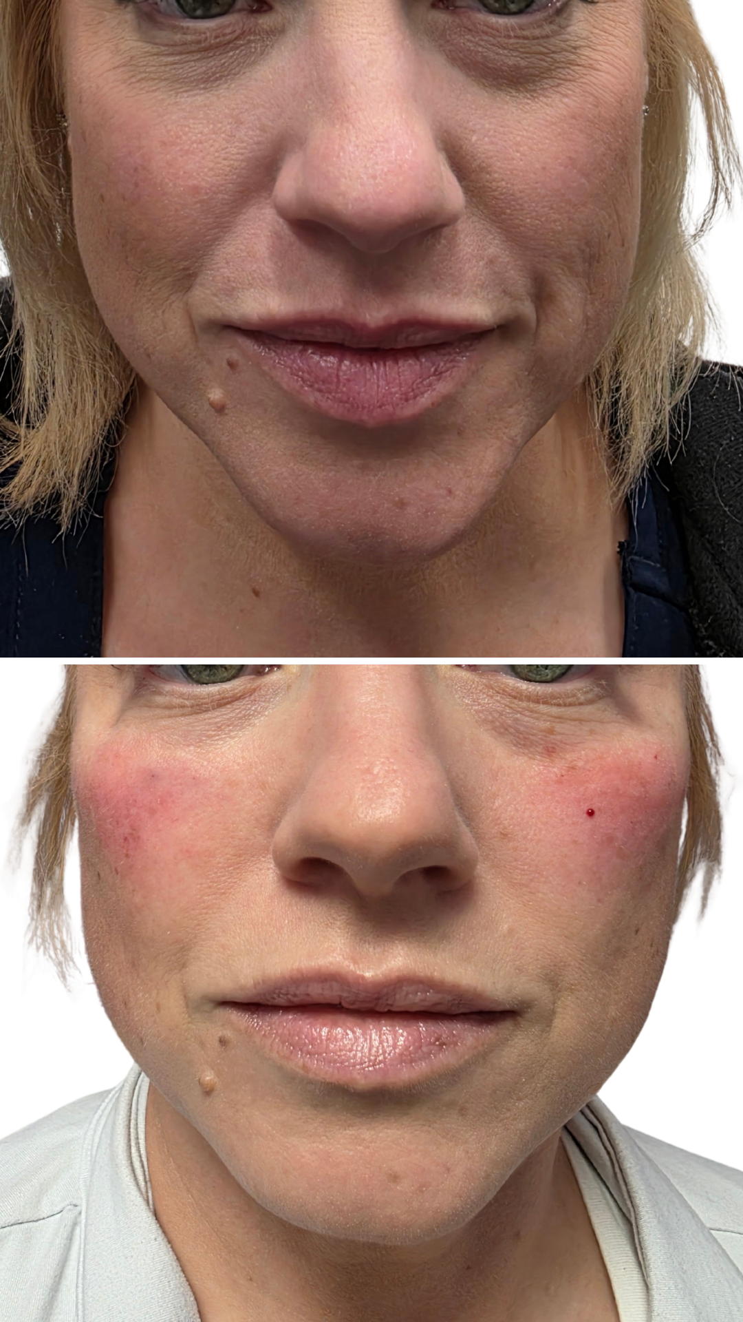 Facial Balancing
Customized treatment to improve facial harmony and create a softer, more balanced appearance.