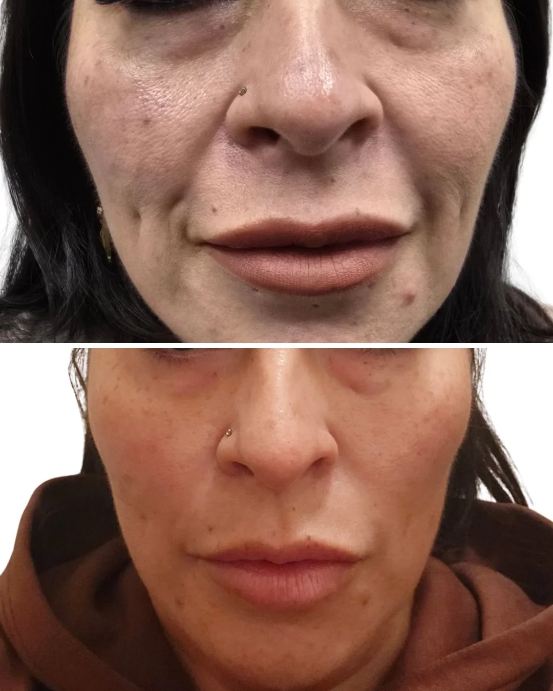 Close-up of two women with visible skin imperfections and small nose piercings, one in a dark shirt and the other in a brown hoodie.