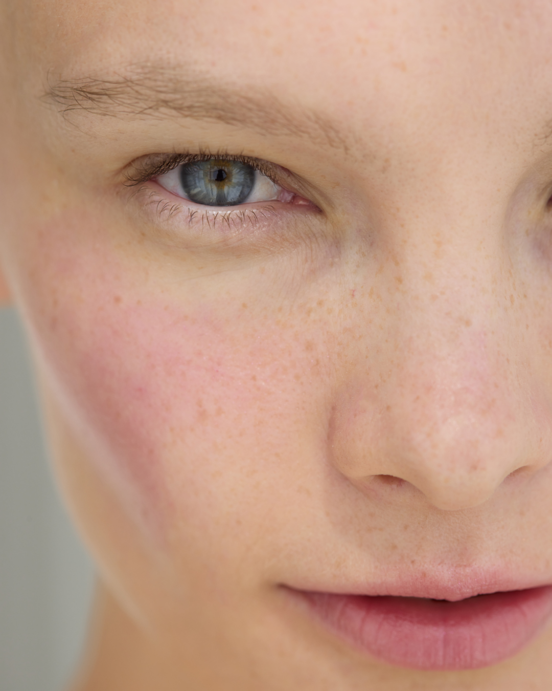 Close-up of a person's face showing the left eye, part of their nose, and lips with natural skin freckles.