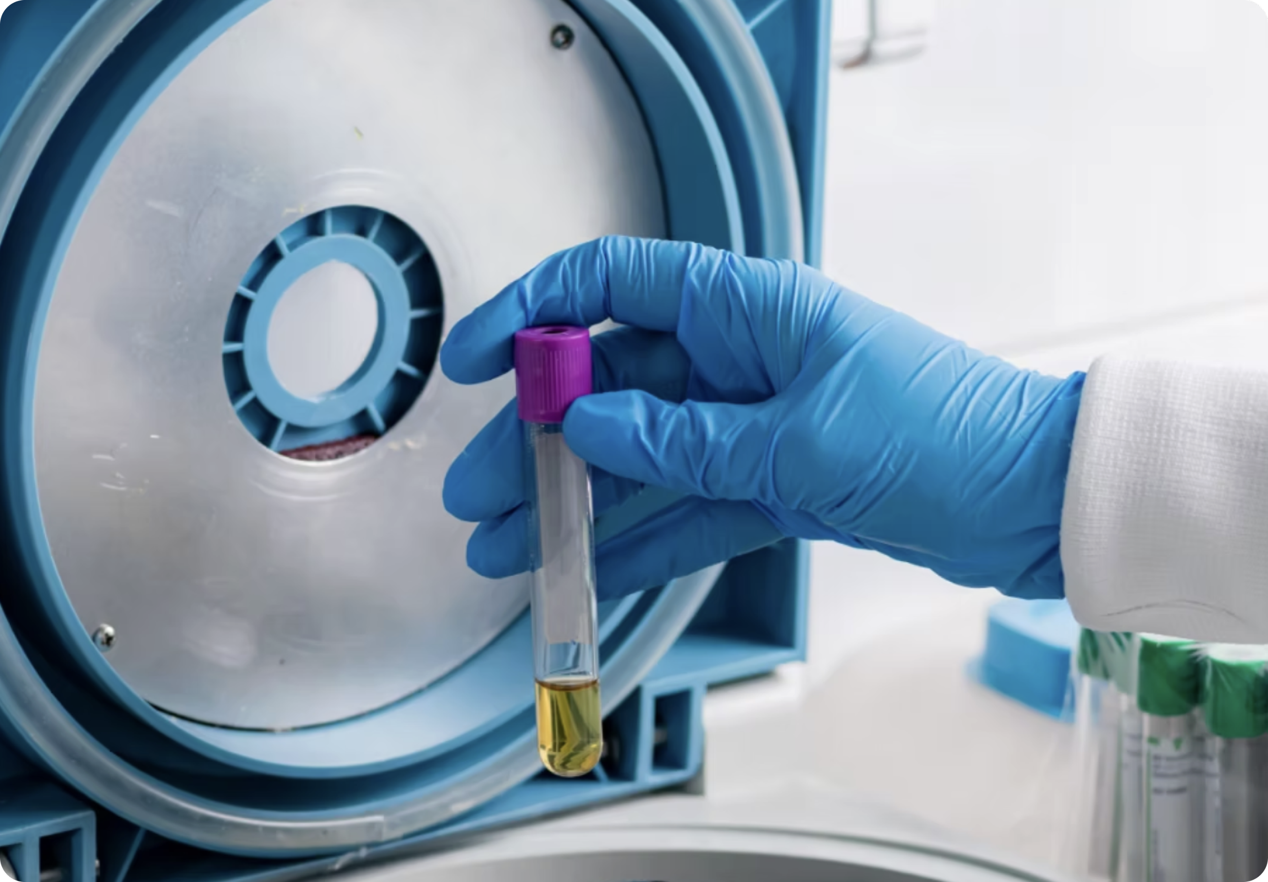 A lab technician wearing blue gloves using a centrifuge to handle a small vial filled with a yellow liquid in a laboratory setting.