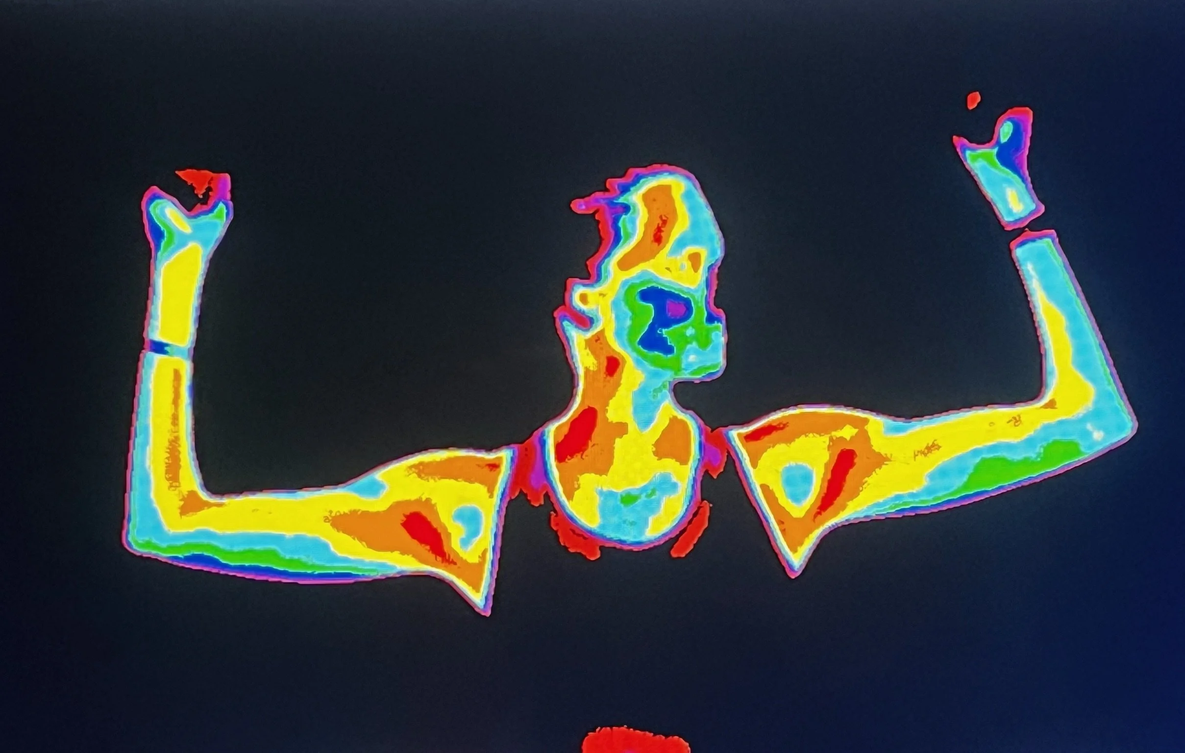 Thermography images used to show inflammation