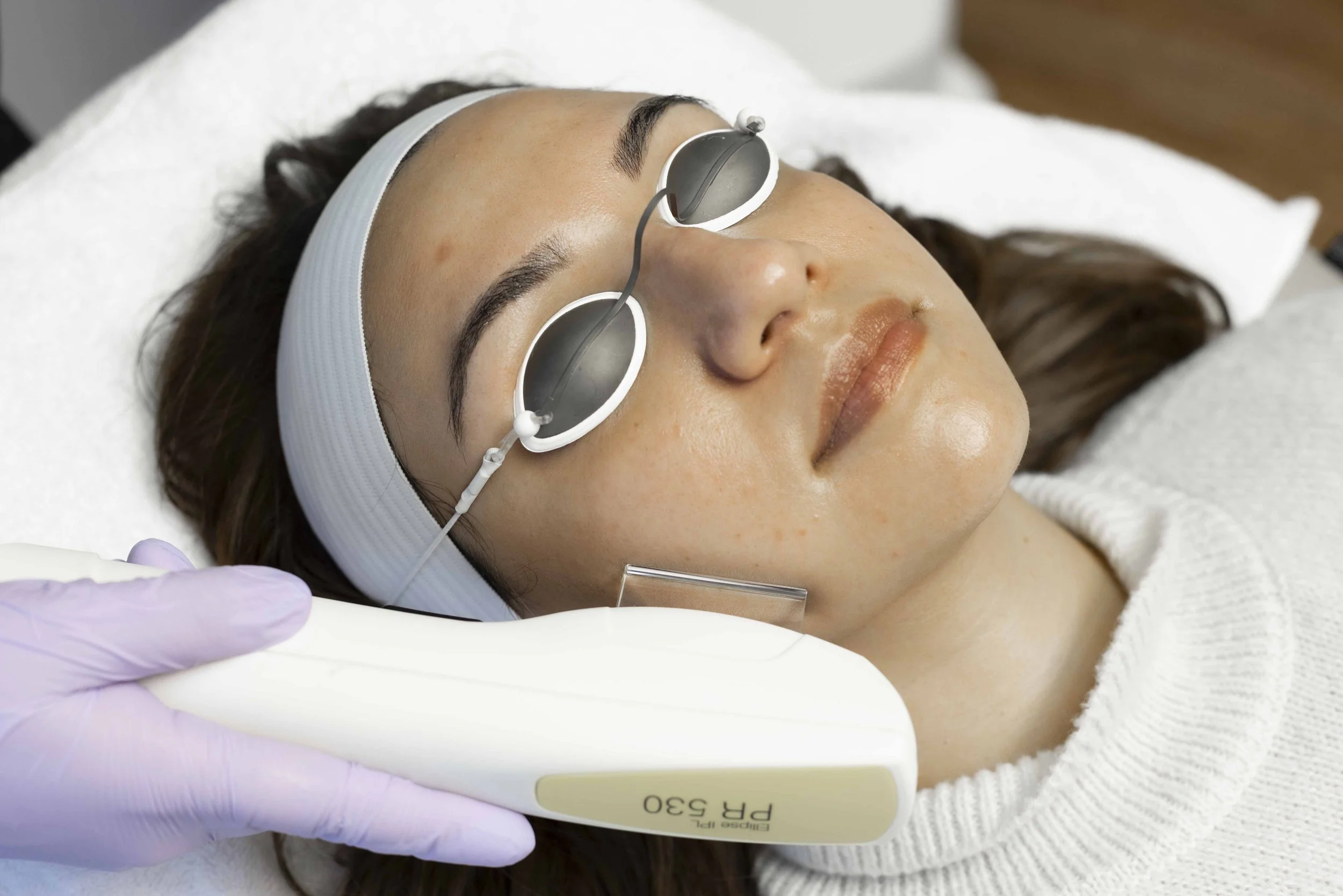 Nordlys IPL photofacial treatment at Eleva Glow Medical Spa in Woodbridge Virginia