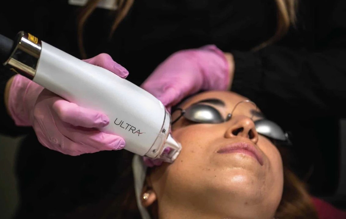 LaseMD resurfacing laser Aria Dermatology Victoria Moss Colorado Springs