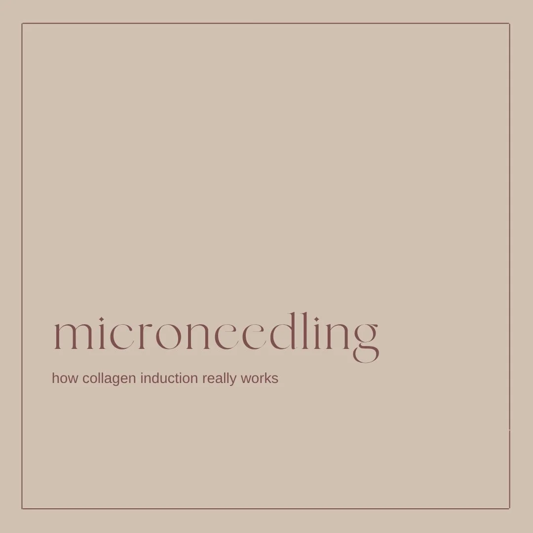 Skin Needling has found it's way to the Grounded Body and Skin line-up. 

Designed to revitalise texture, soften acne scarring, and restore a youthful glow.

EXCLUSIVE INTRODUCTORY OFFER
Only $660 (Total Value $975) 
First 5 bookings only! 

What&rsq