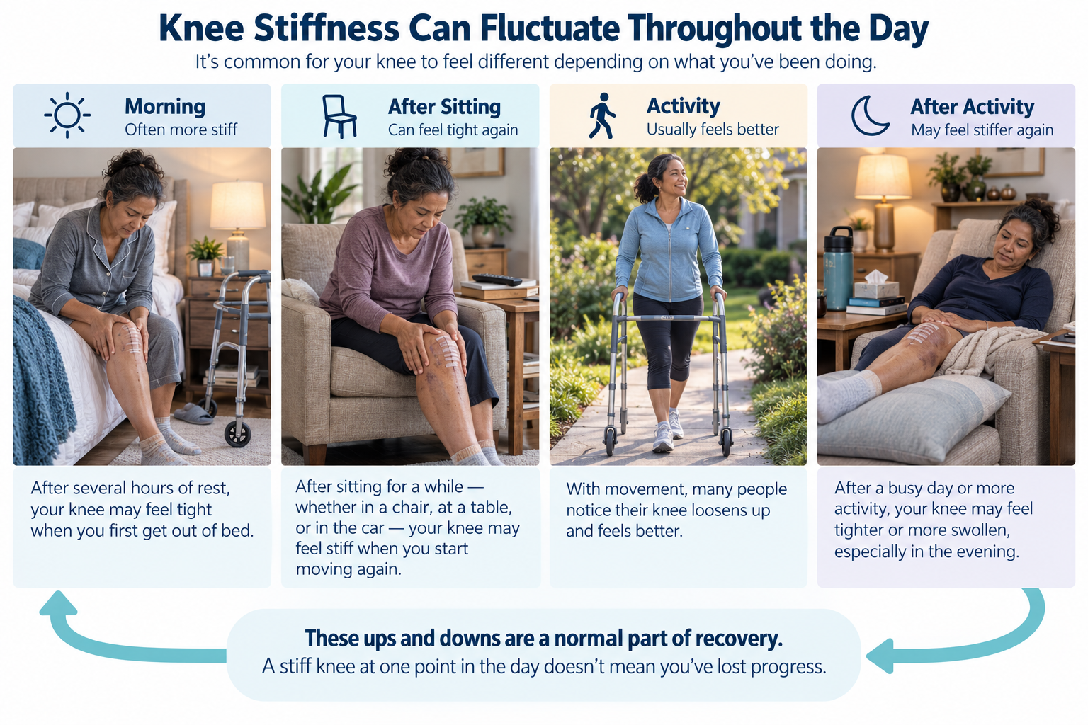 Knee replacement stiffness can fluctuate throughout the day with morning stiffness, sitting, activity and increased stiffness after activity