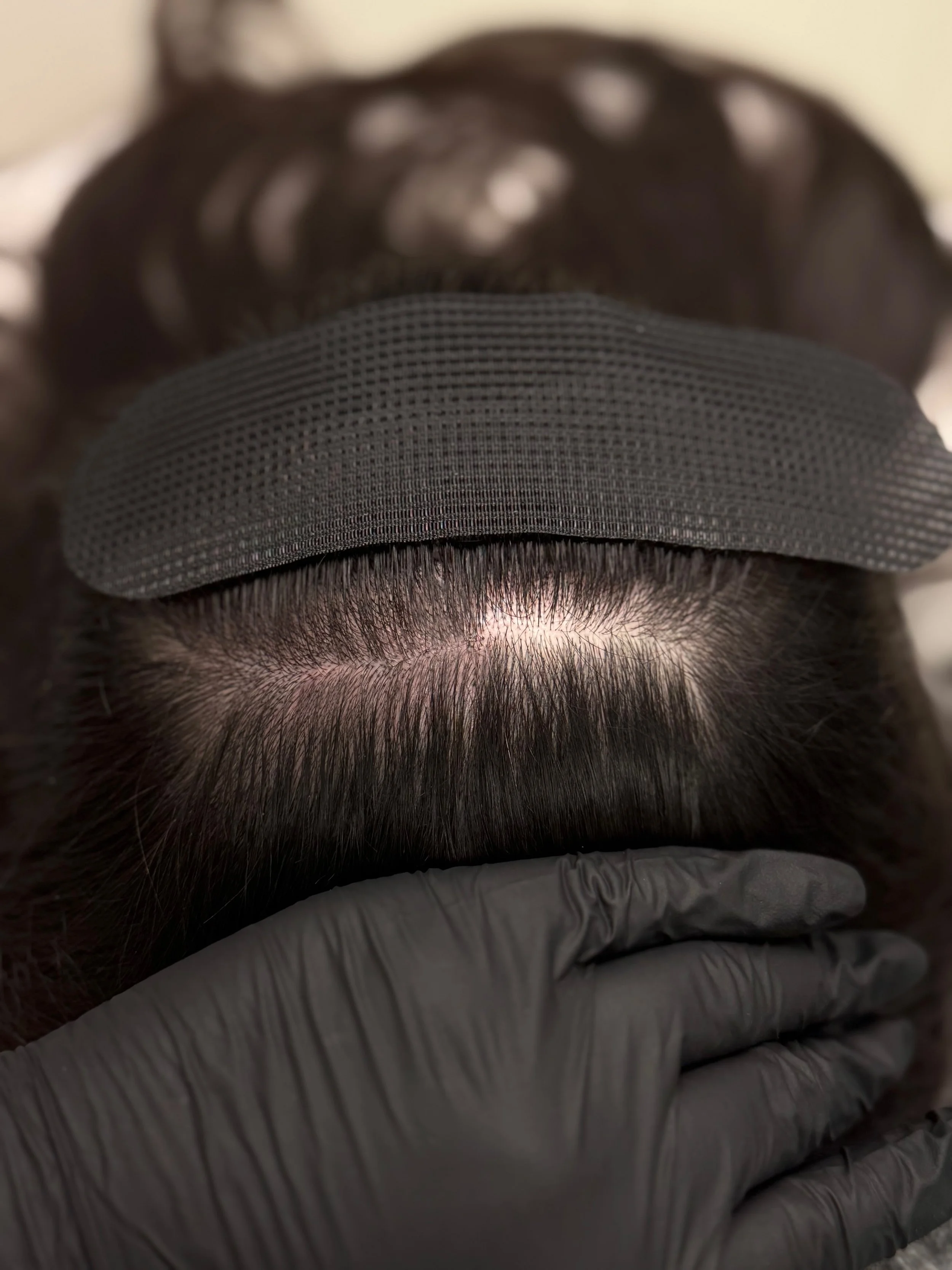 scalp density fill dark brown hair 