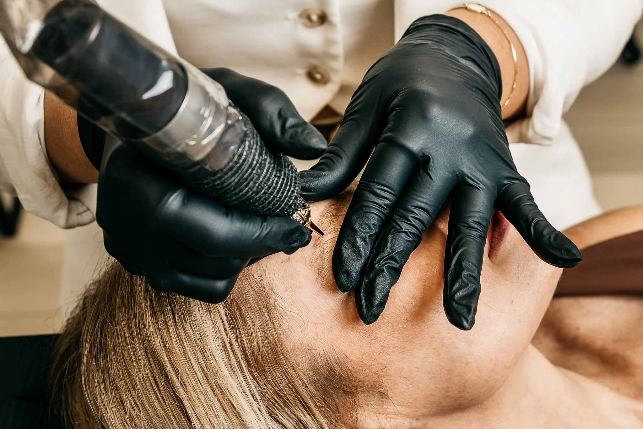 A person receives a cosmetic or medical procedure on their face, with another individual wearing black gloves performing the procedure using specialized tools.
