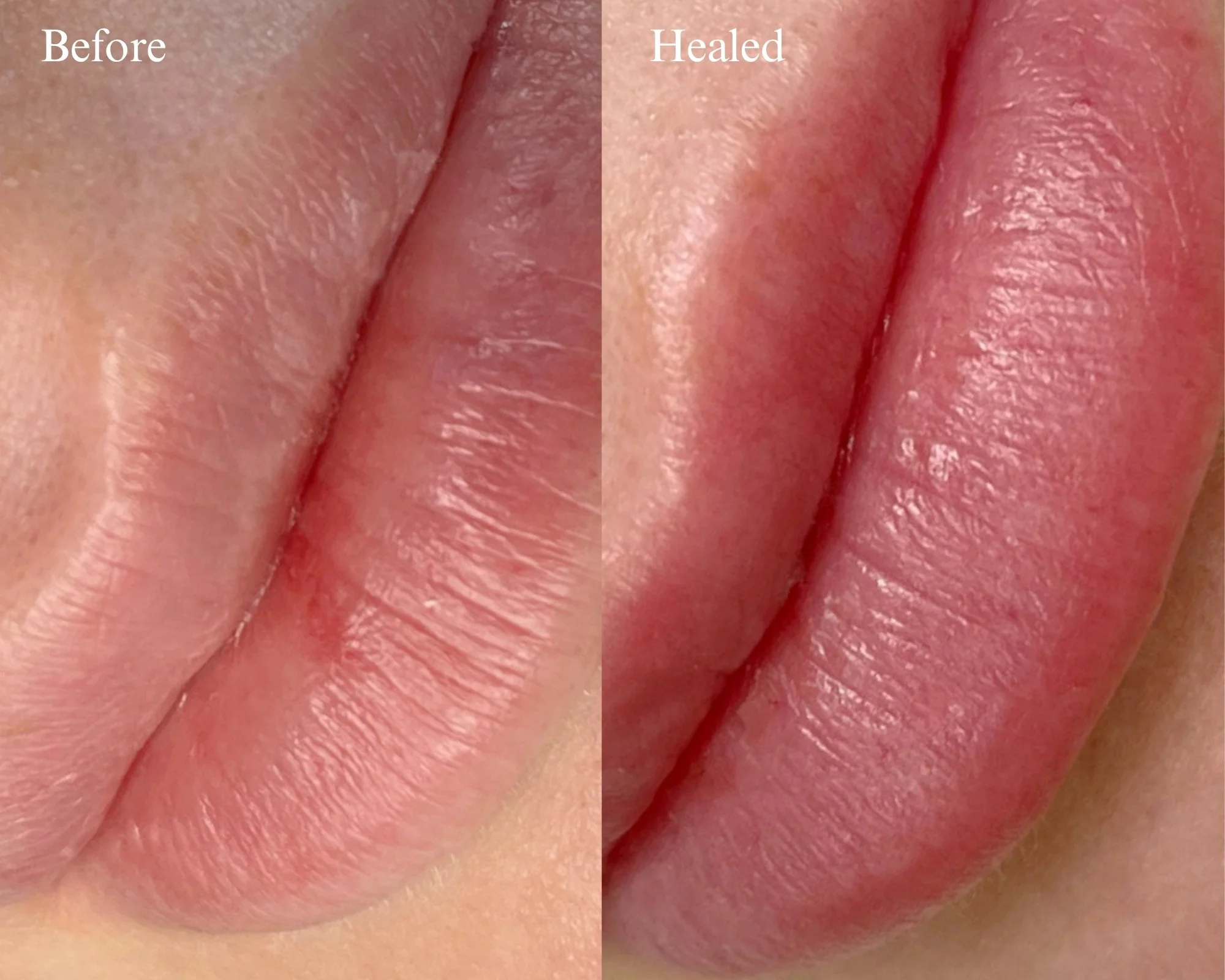 Close-up comparison of skin with and without healing scar, showing smooth skin on the healed side and rough, irritated skin on the before side.