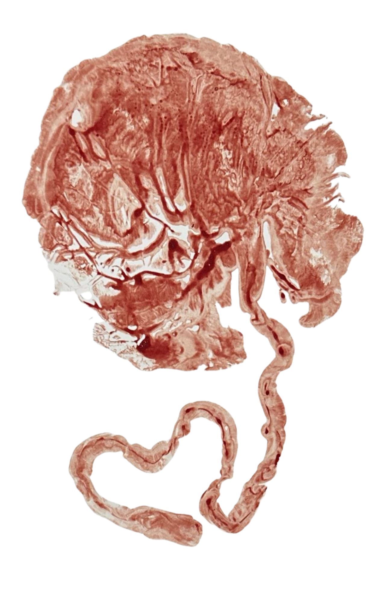 Placenta print made using blood with heart shaped umbilical cord. Birth and Bloom Placenta Encapsulation & Doula Services, Elise Smith Tucson, AZ