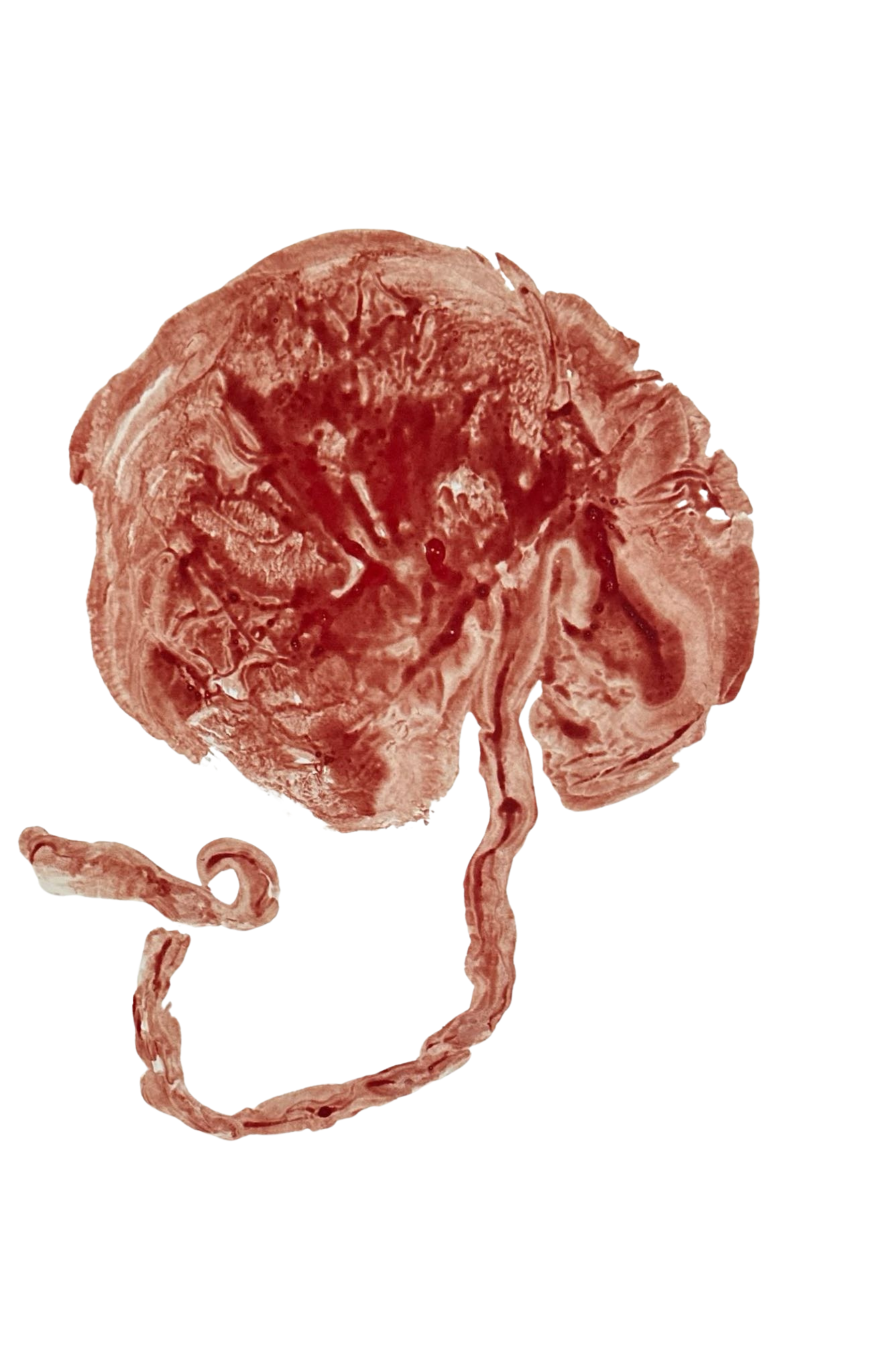 A photo of a placenta print made with blood on a white background. Birth and Blood Placenta Encapsulation & Doula Services, Elise Smith Tucson, AZ 