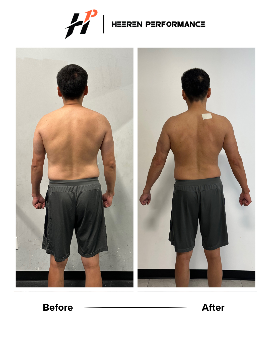 Side-by-side comparison of a man's back before and after physical therapy or training, showing visible muscle and posture improvement, with the 'after' image having a bandage on the upper back.