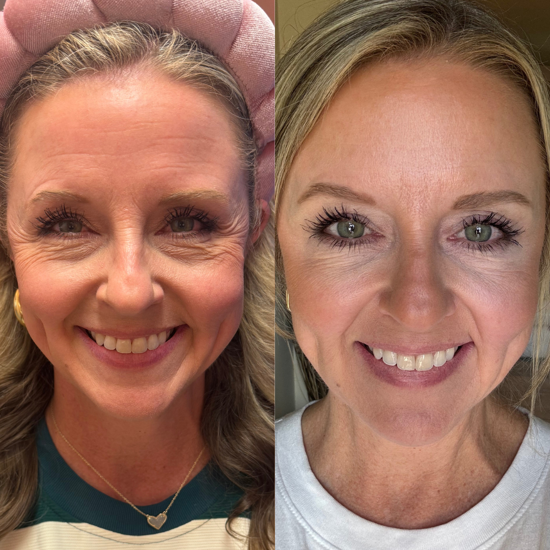 Side-by-side comparison of two women smiling, showing their faces with clear skin and eye makeup, one wearing a pink headband and the other in a white shirt.