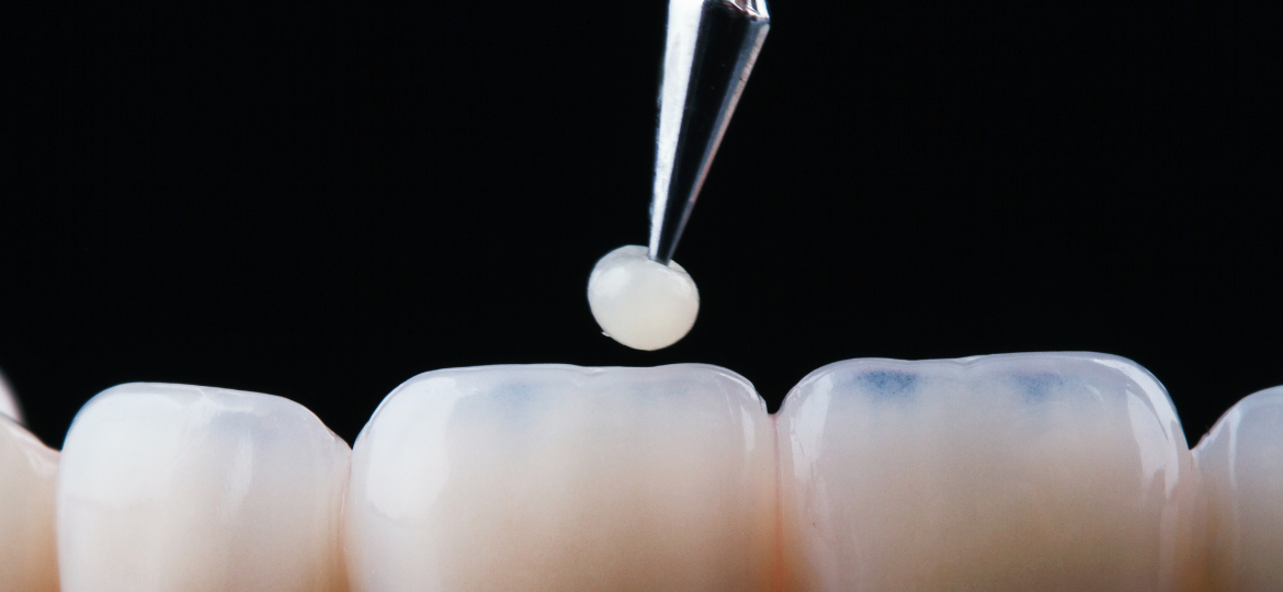 AI-assisted Multiscale Simulation Framework for Intentional Design of Dental Restorative Materials 