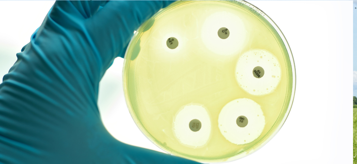 Antimicrobial Resistance Dynamics: Before, During, and After the COVID-19 Pandemic