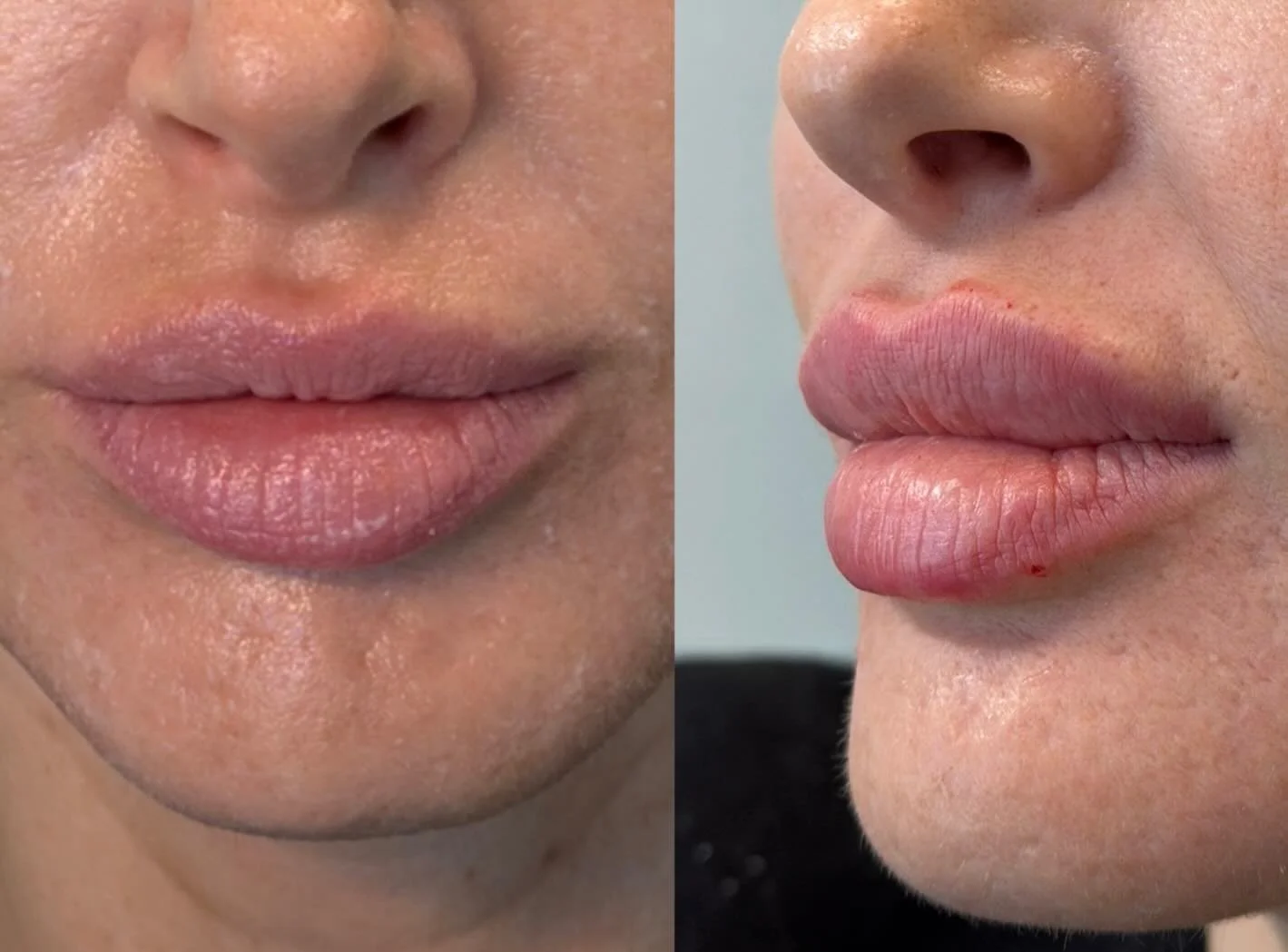 Santa baby I&rsquo;d love some Baby Doll lips 😍💋☺️