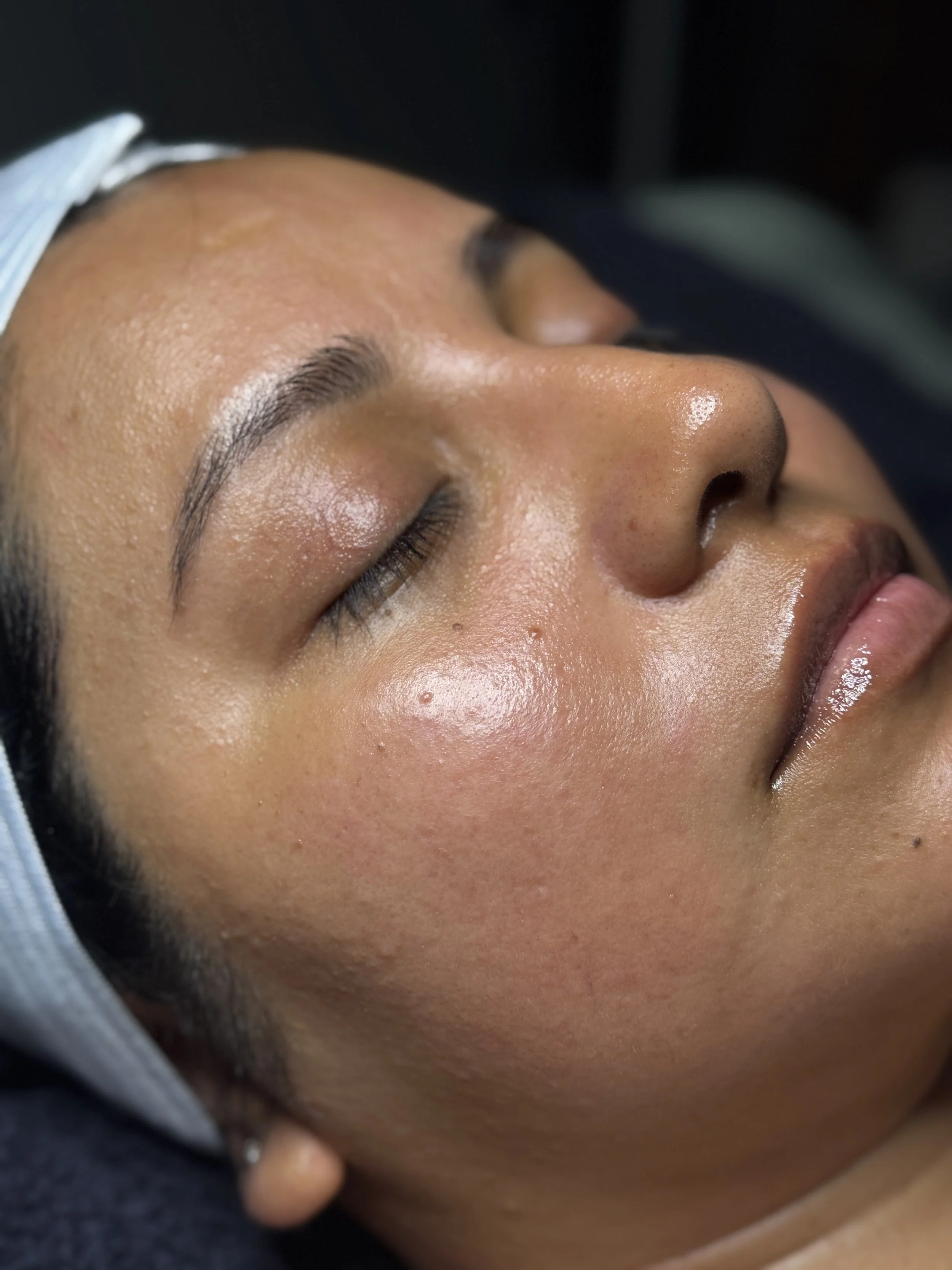 Close-up of a woman's peaceful face with closed eyes, lying down, possibly receiving a skincare treatment.