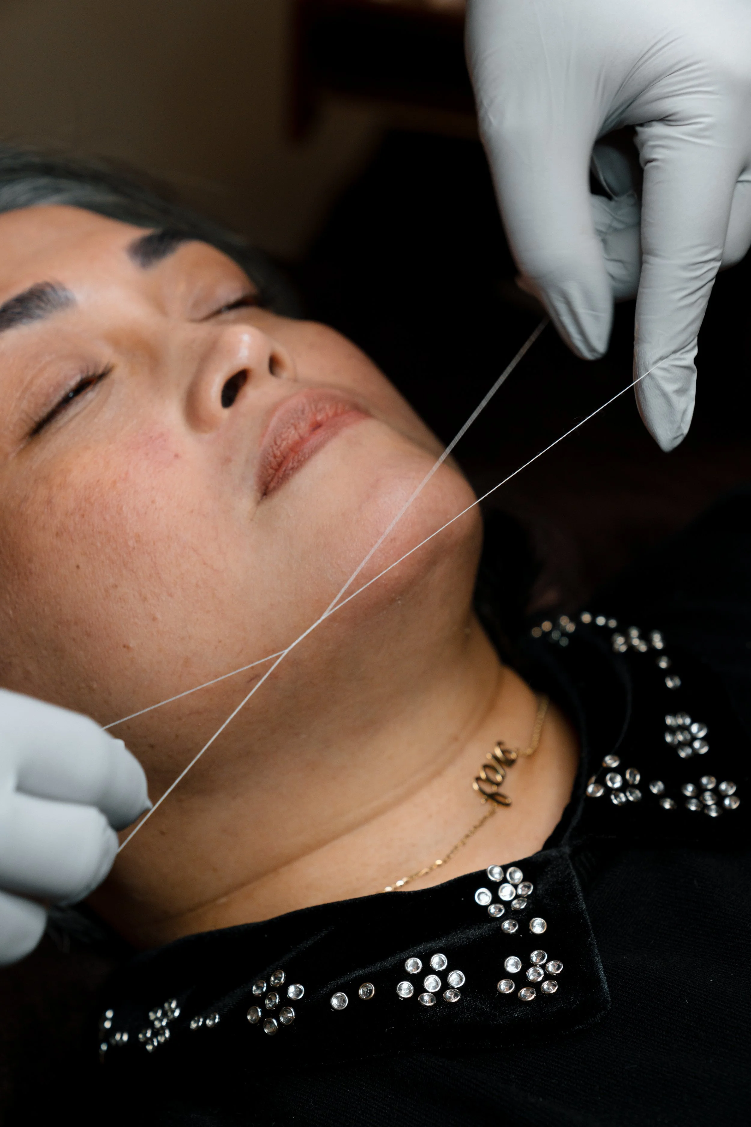 A woman receiving a cosmetic treatment with a needle, lying down with eyes closed, wearing a black top with jeweled embellishments and a gold necklace.