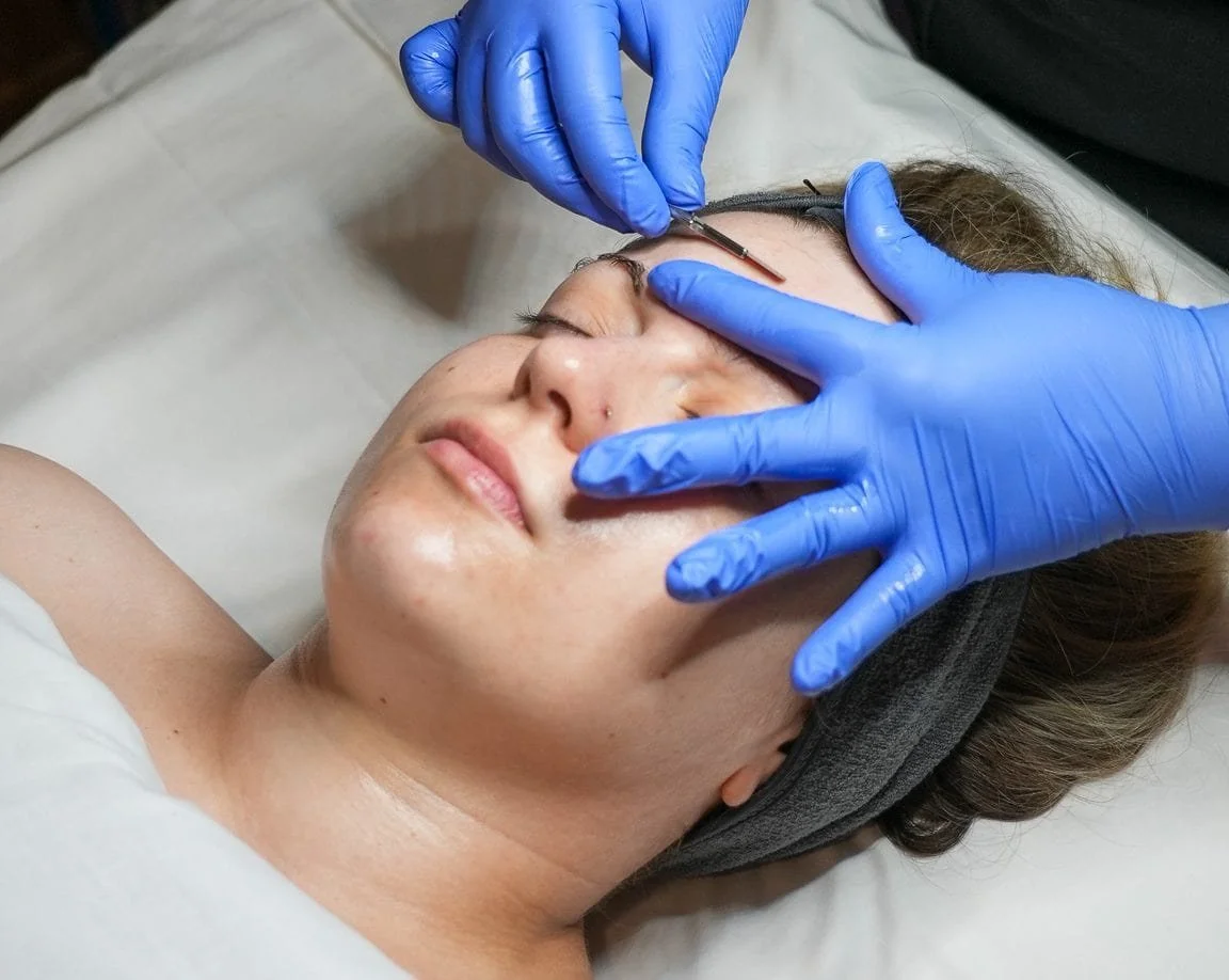 woman receiving dermaplaning treatment