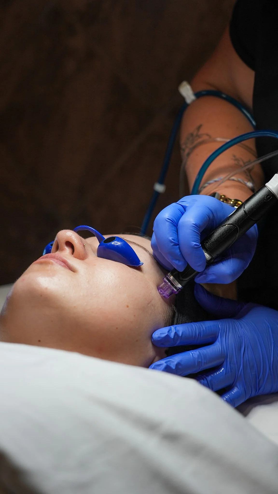Women receiving Hydrafacial