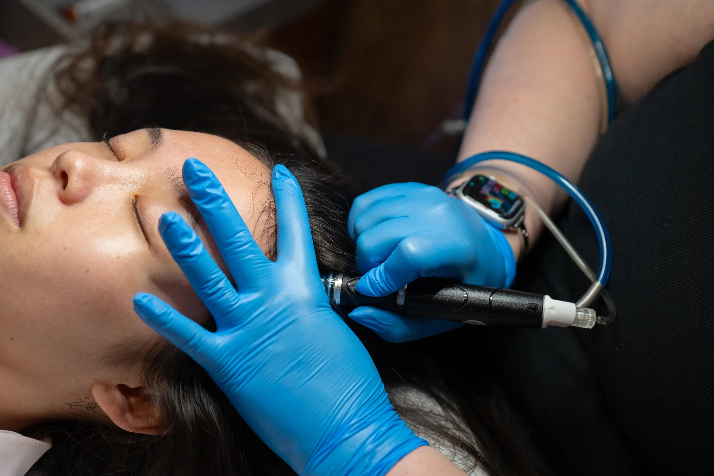 HydraScalp treatment