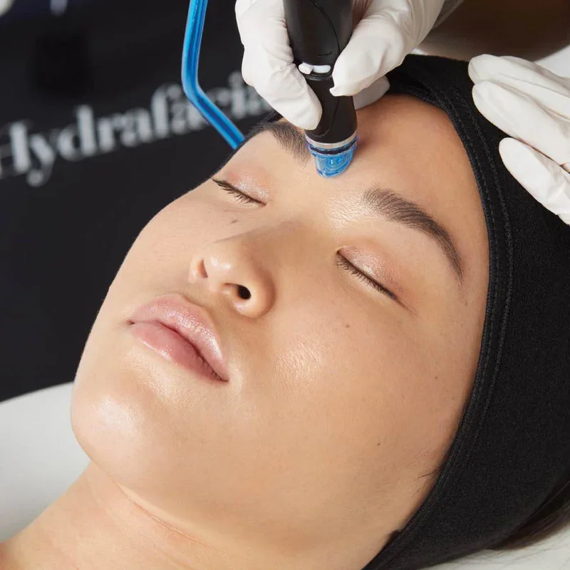 woman receiving hydrafacial