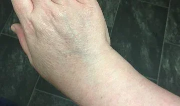 Living with Autoimmune Conditions: Supporting the Body Without Overwhelming It