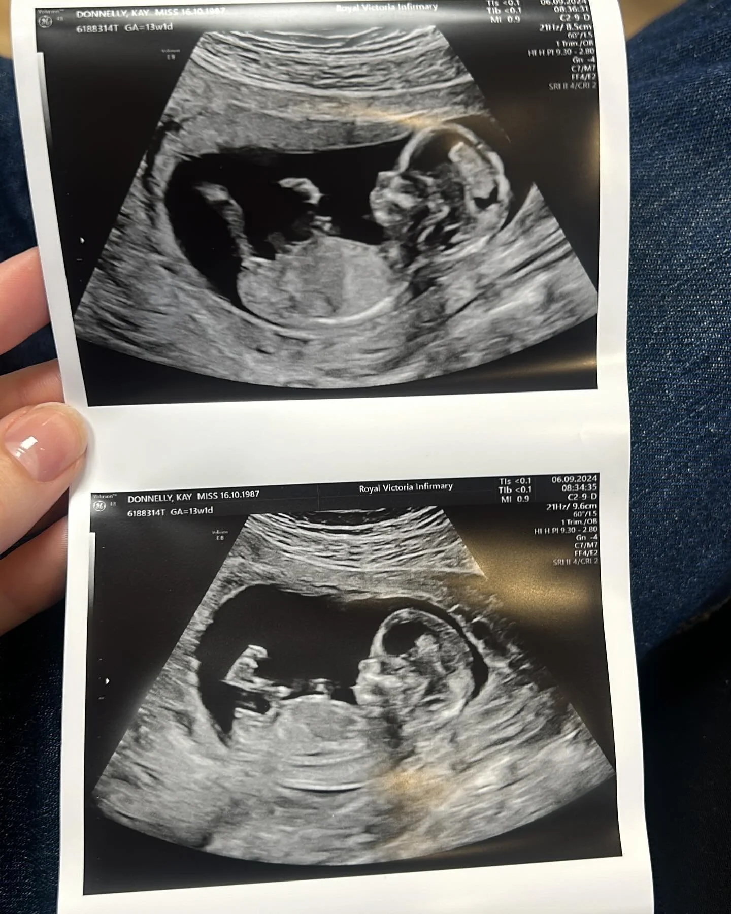 What a crazy, beautiful year so far!! Being pregnant has been wild (!) and has taught me so much about myself, and so much about pregnancy that I never knew! Whilst this has not been the easiest 9 months of my life (🫣) it has still been magical and 