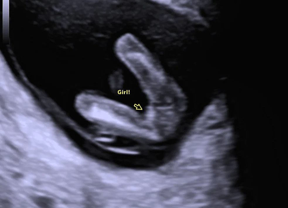 Gender Reveal 
$75