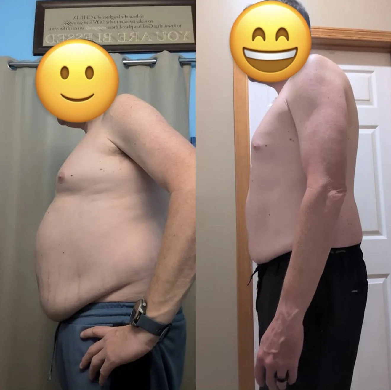 Side-by-side comparison of a shirtless man showing significant weight loss, with before and after photos. The left photo shows him with a larger abdomen, while the right shows a slimmer, more toned physique.