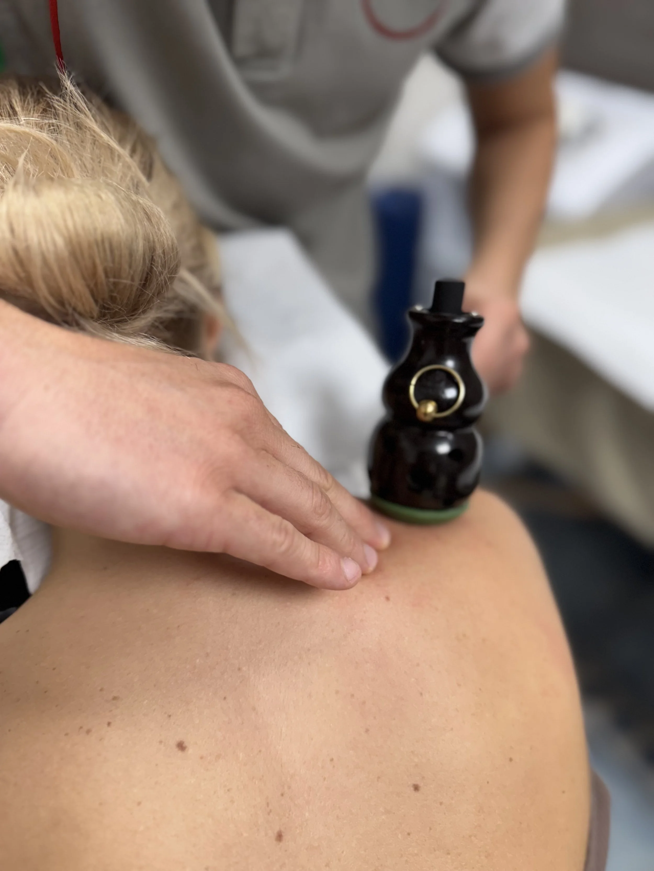 Una persona riceve un trattamento di medicina alternativa con un bastone di legno o ceramica.