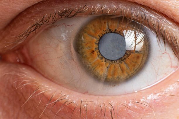 Close-up of a human eye showing a gray contact lens, brown iris, and surrounding skin with eyelashes.