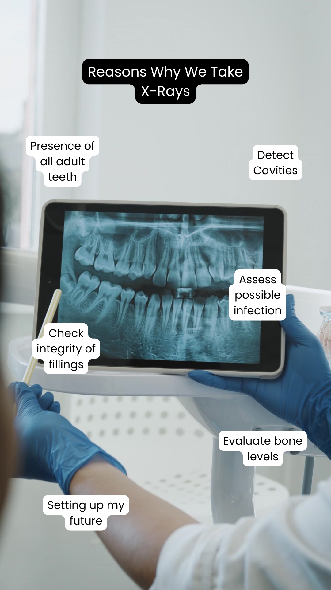 why do we take xrays .png